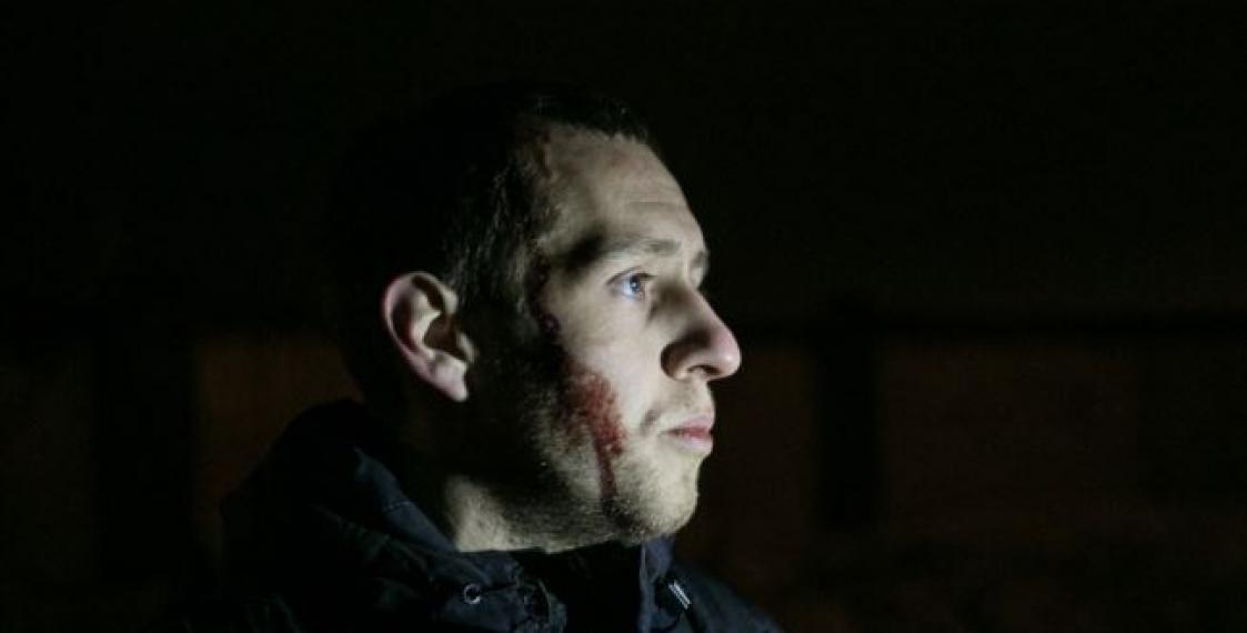 Kurapaty defenders get attacked and beaten by masked people