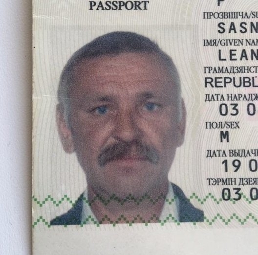 "Пришельцу" из Речицы так и не сделали операцию: воспаление переросло в злокачественную опухоль