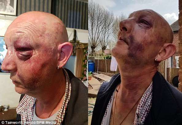 14 отморозков избили умственно отсталого пенсионера, сломав ему челюсть и рёбра