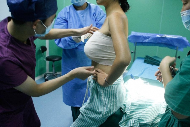 "Пластика Золушки": японцы практикуют увеличение груди на сутки