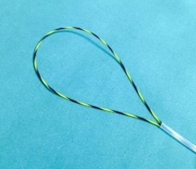 Медики изготовили новый инструмент, чтобы вытащить из итальянца секс-игрушку