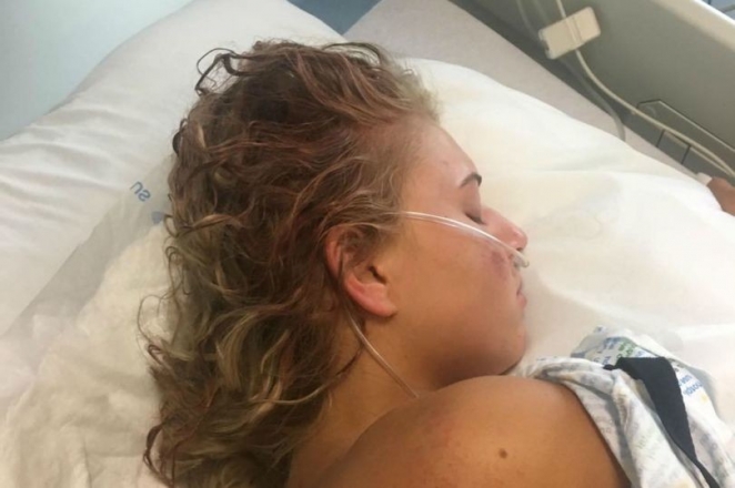 Студентка выпила коктейль в ночном клубе и выпрыгнула из окна из-за галлюцинаций