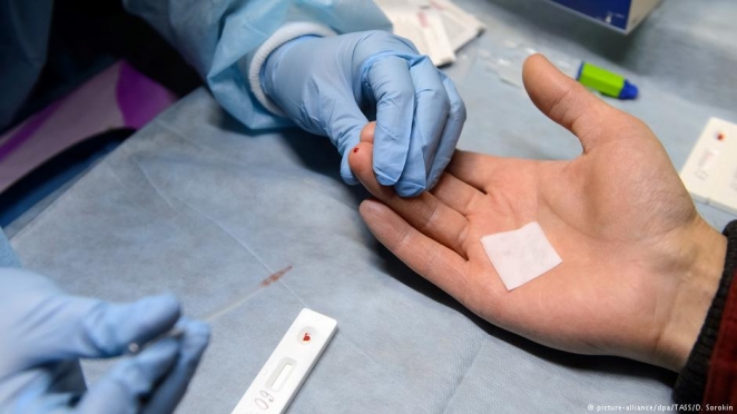 Жизнь с ВИЧ: в Германии, Беларуси, Казахстане и России