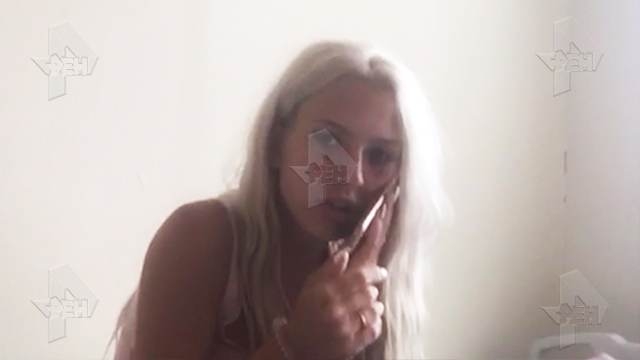 Фото: звезду "Дома-2" били по лицу до переломов Фото: звезду "Дома-2" били по лицу до переломов