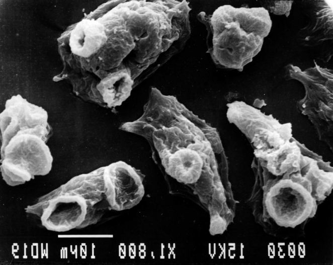 Пожиратель мозга: паразит, питающийся мозгом человека