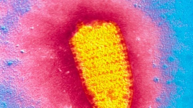 Укушенный котом во время отпуска в Марокко британец умер от бешенства Укушенный котом во время отпуска в Марокко британец умер от бешенства