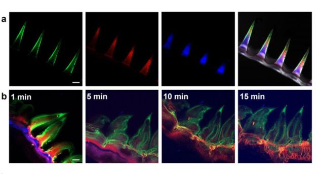 Колючие контактные линзы - новое слово в лечении глазных болезней Колючие контактные линзы - новое слово в лечении глазных болезней