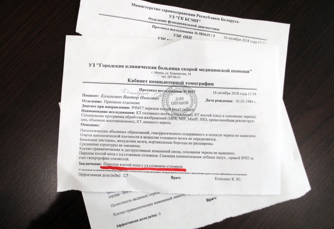 "Да не сдохнешь ты". Минчанина в отделении милиции подвесили на крюк, били, сломали нос