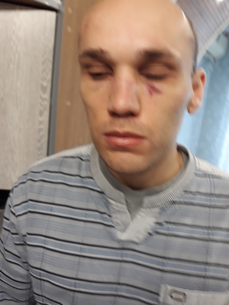 В Крыму во время приема граждан мужчина с белой тростью облил зеленкой депутата Госдумы