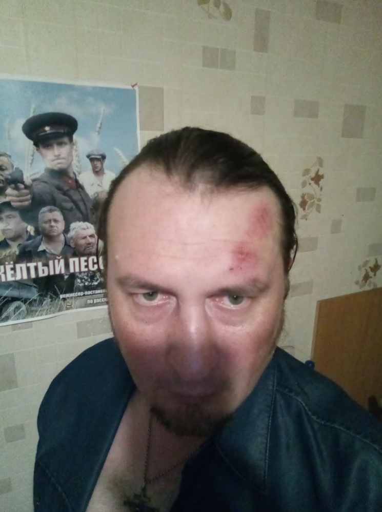 Сбор подписей закончился побоями и судмедэкспертизой, но претендент на депутатский мандат сдаваться не намерен