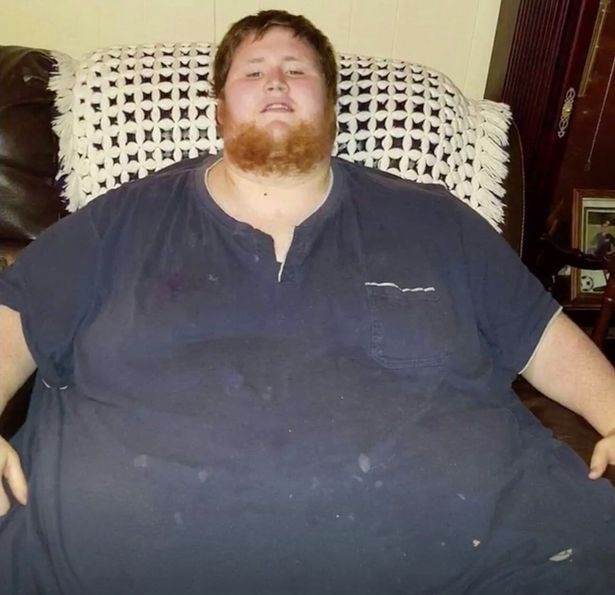 Фантастика! Парень похудел на 272 кг: фото "до и после"