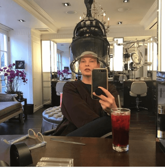 Супермодель Линду Евангелисту изуродовали на косметической процедуре