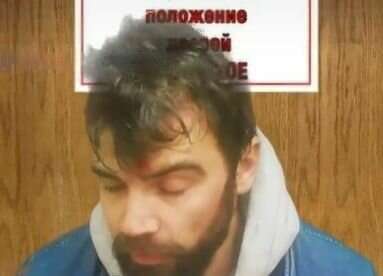 Лукашисты разбили голову мужчине за белорусскую наклейку на авто