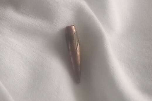 «Попала пуля прямо в грудь и пошла по телу». Денис Урбанович о своем состоянии после третьего ранения