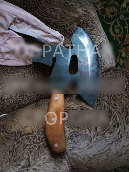 В Минске пациент напал с топором врачей, приехавших его забирать. Двое медиков в реанимации