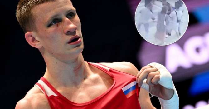 В Крыму мигранты избили чемпиона России по боксу. Ему выбили глаз